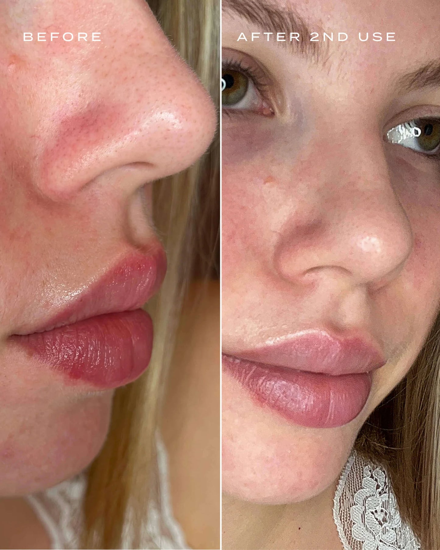 Patch Purifiant Nez