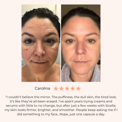 Sicella anti aging capsules