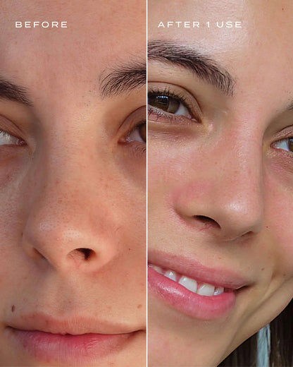 Patch Purifiant Nez