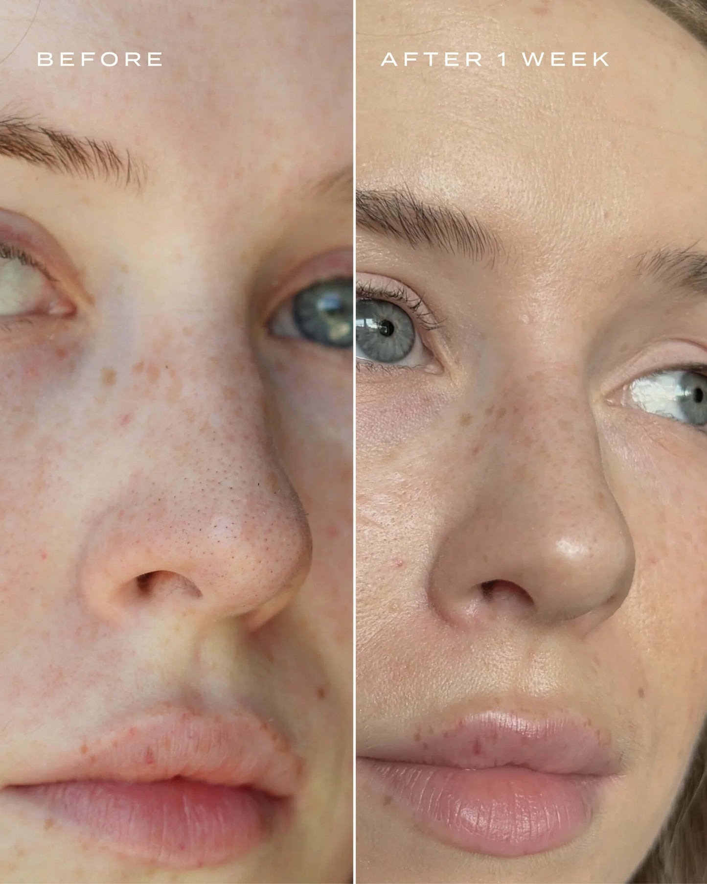 Patch Purifiant Nez