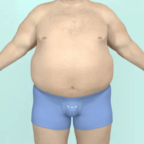 HAUT AMINCISSANT MyFIT™