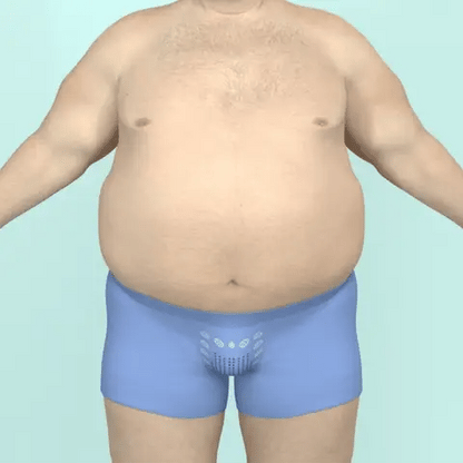 HAUT AMINCISSANT MyFIT™
